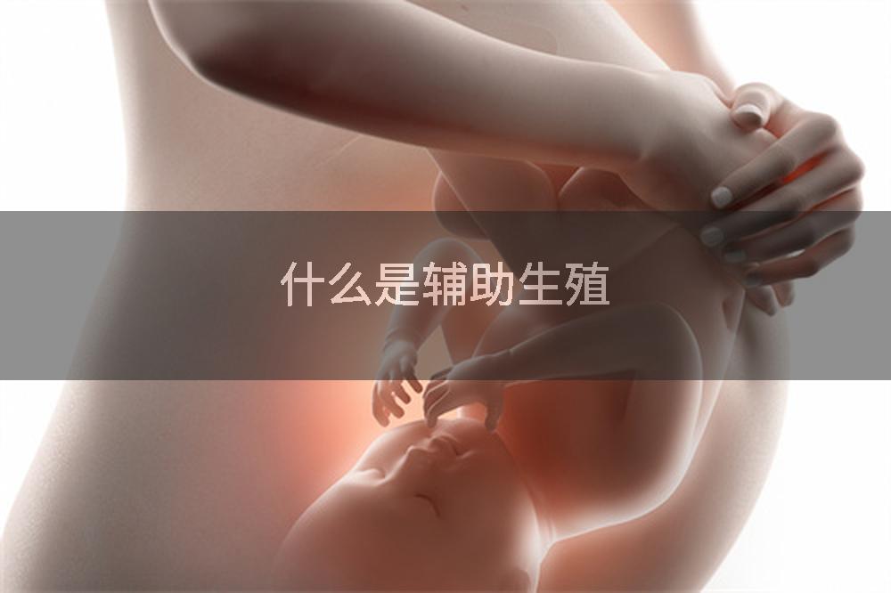 什么是辅助生殖