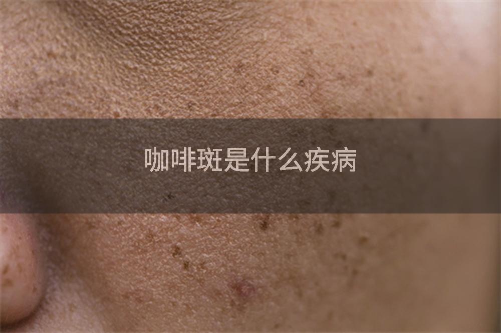 咖啡斑是什么疾病