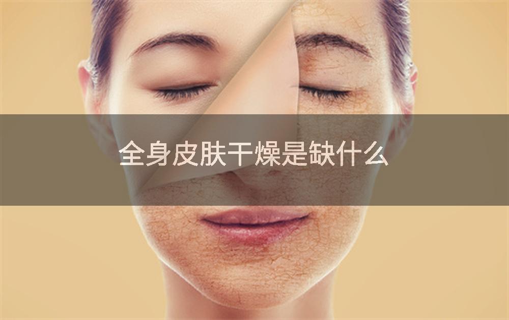 全身皮肤干燥是缺什么