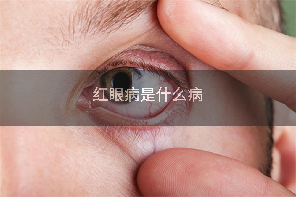 红眼病是什么病