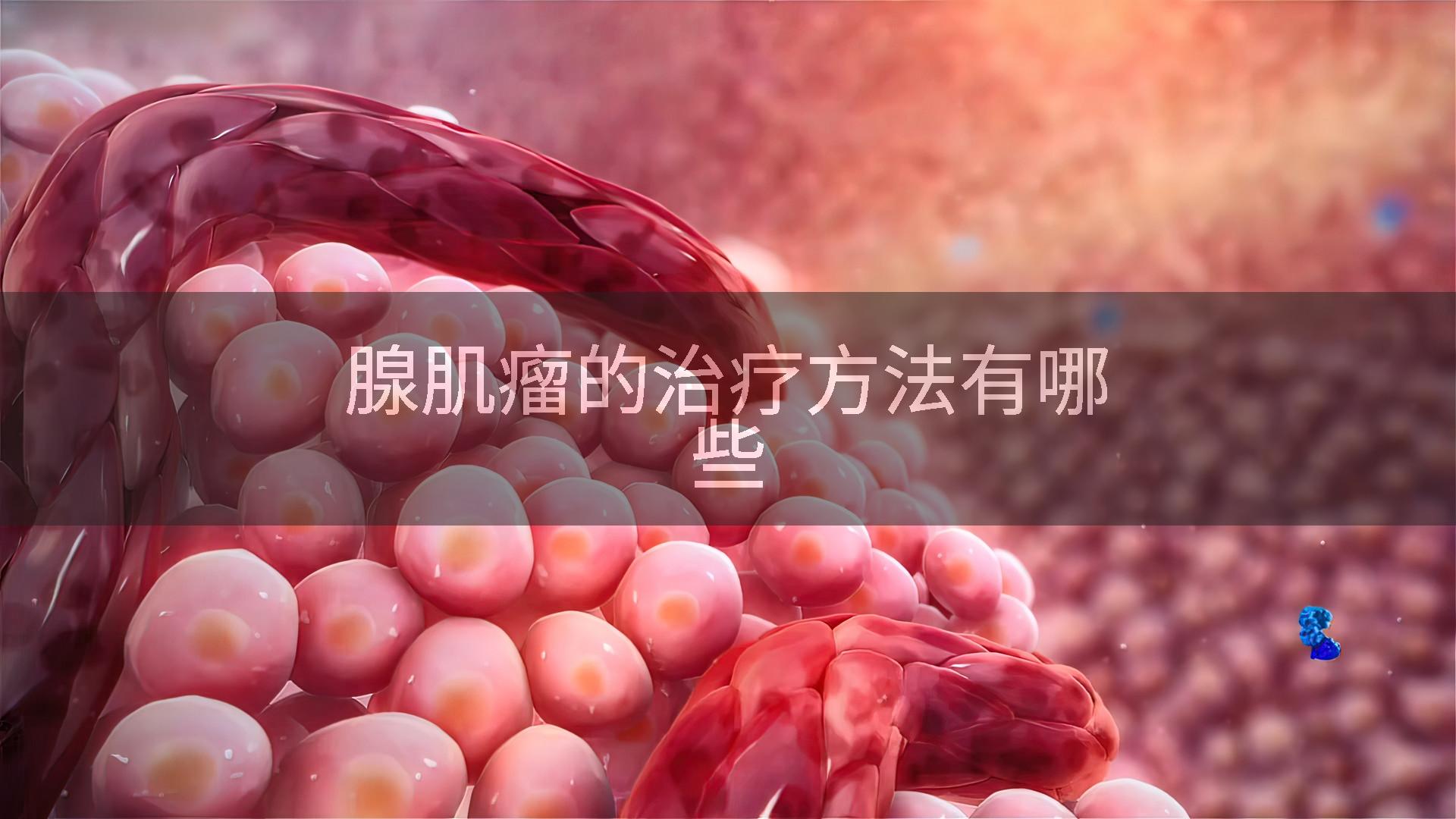 腺肌瘤的治疗方法有哪些