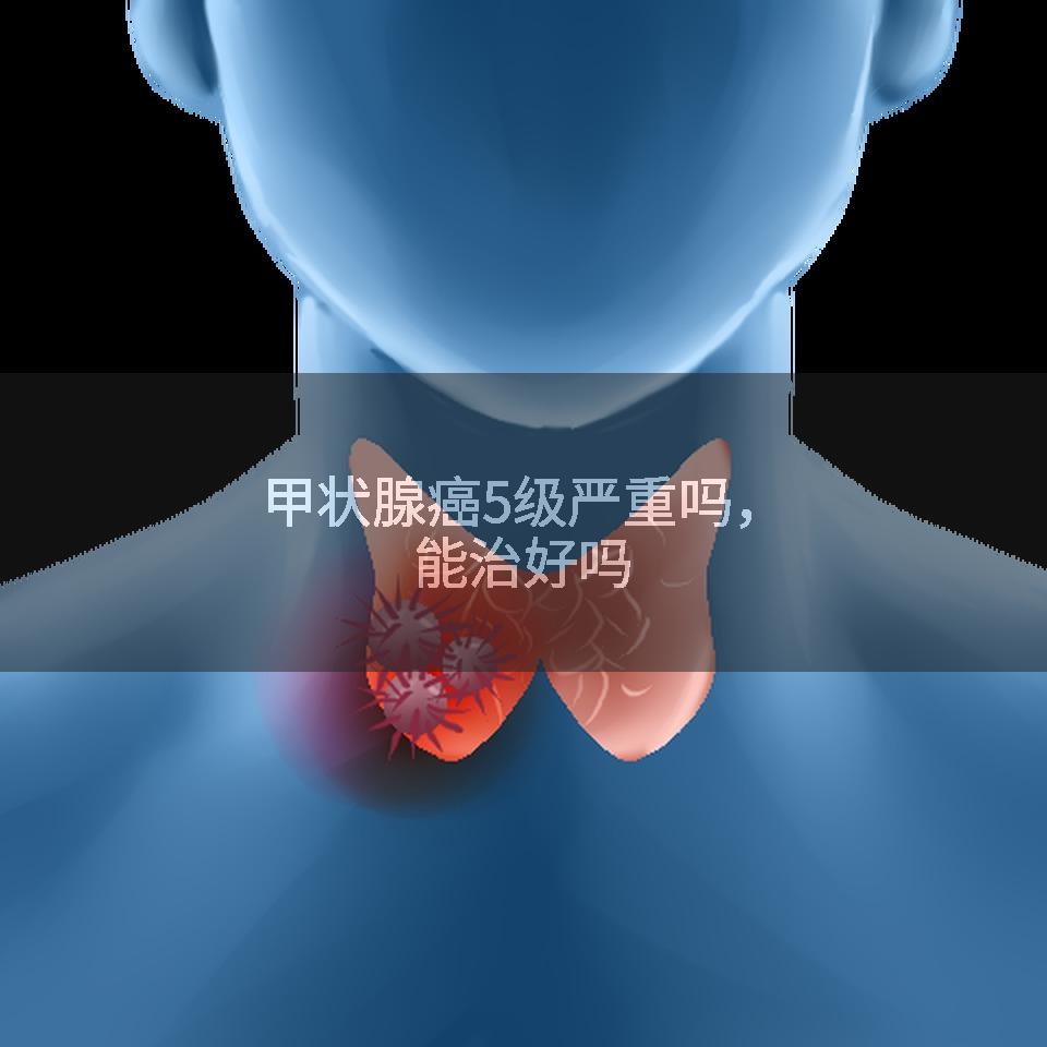 甲状腺癌5级严重吗，能治好吗