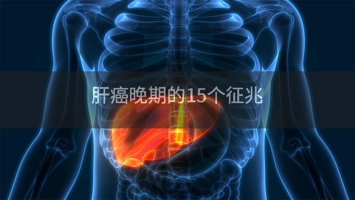 肝癌晚期的15个征兆