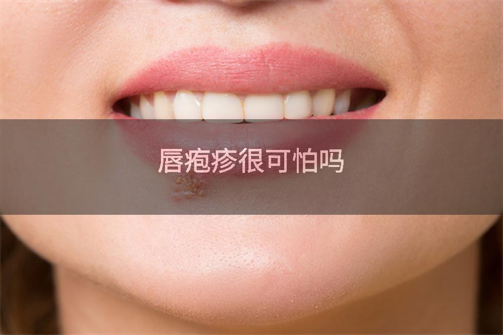 唇疱疹很可怕吗