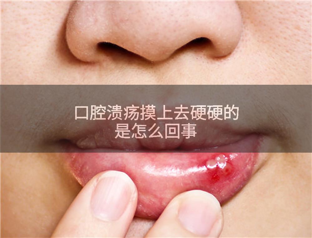 口腔溃疡摸上去硬硬的是怎么回事