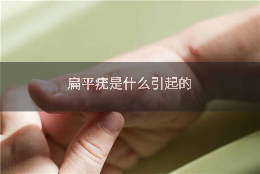 扁平疣是什么引起的