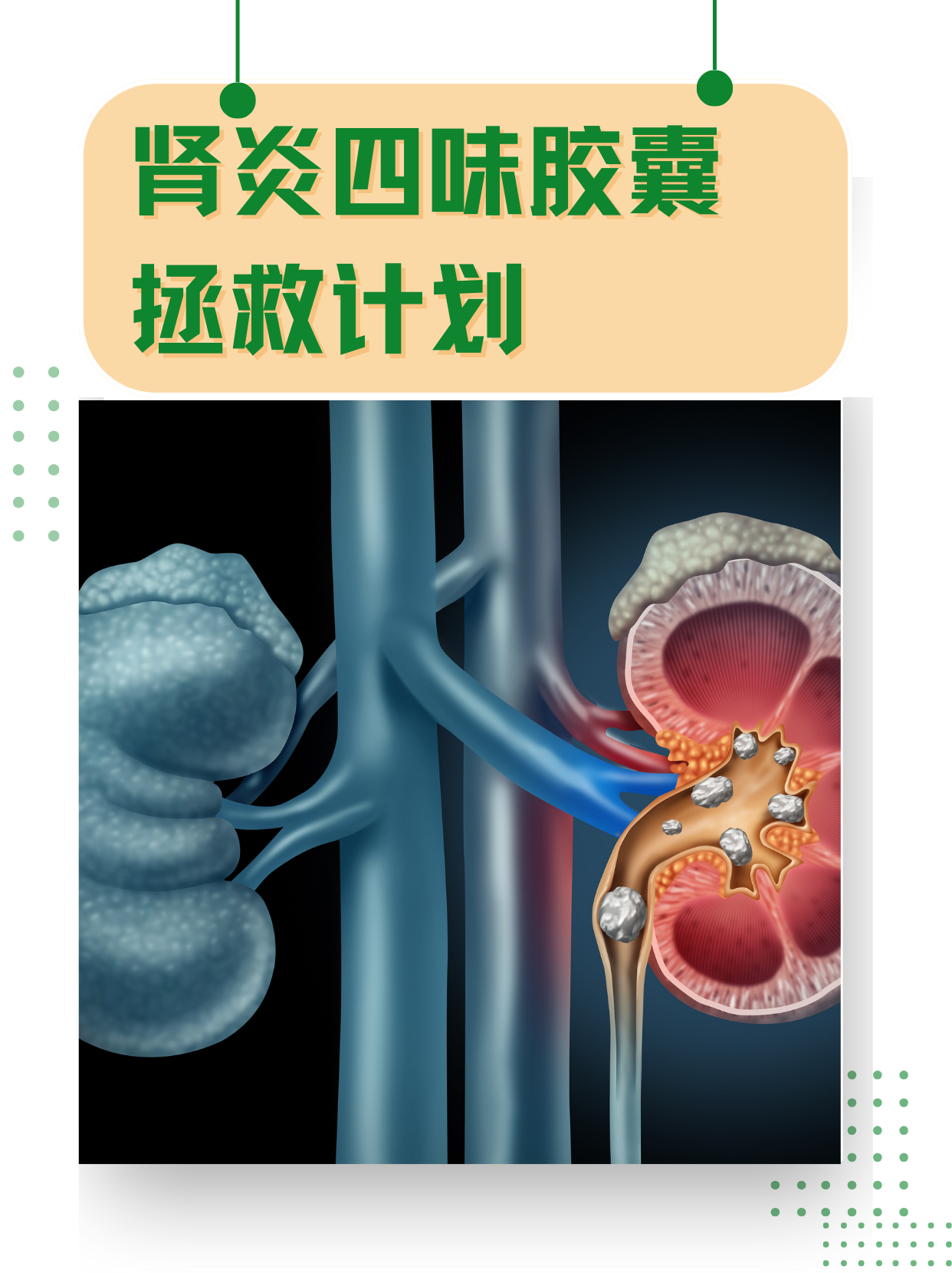 肾炎四味胶囊拯救计划!个人实战经验分享✨