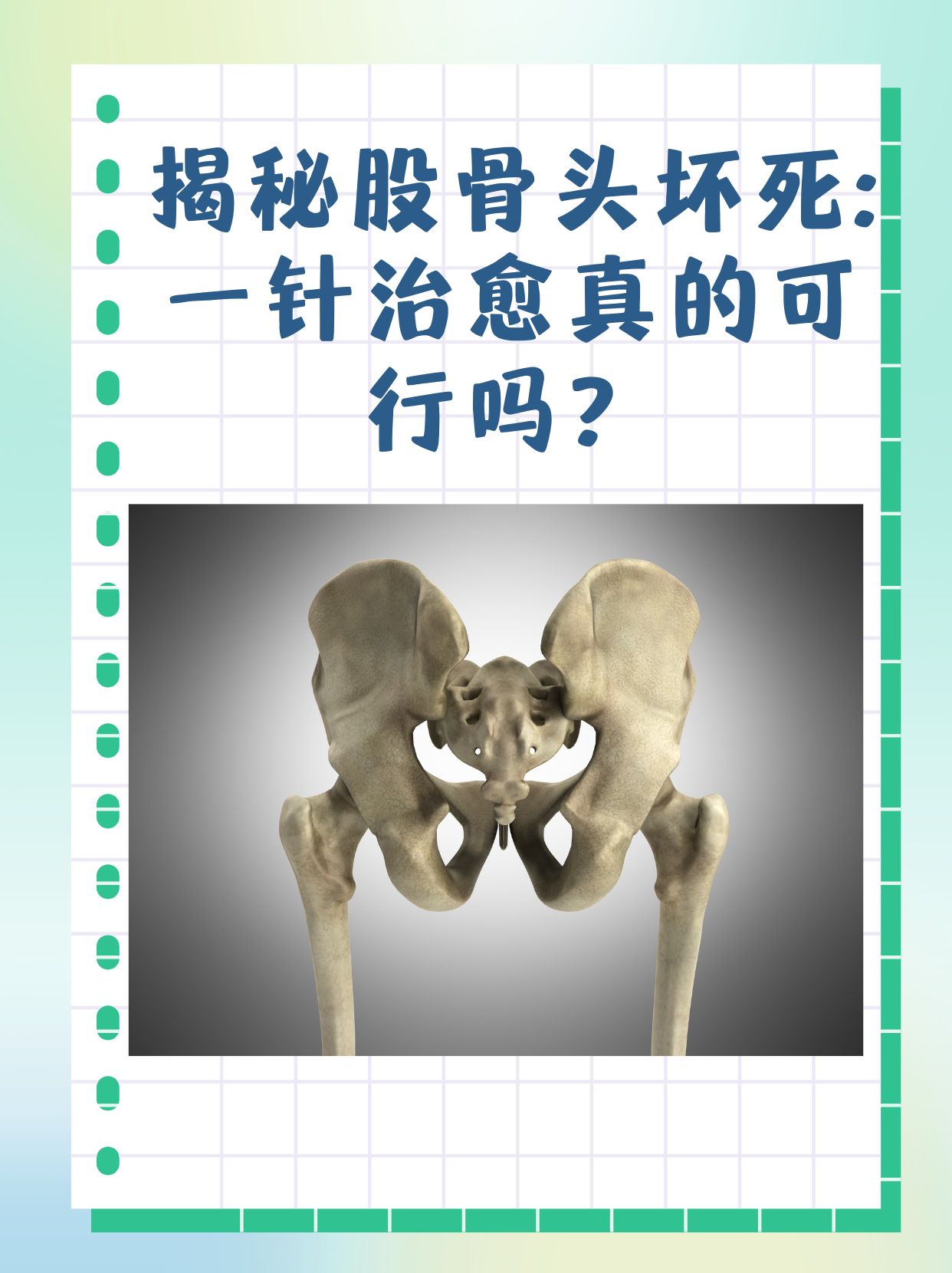 揭秘股骨頭壞死：一針治愈真的可行嗎？